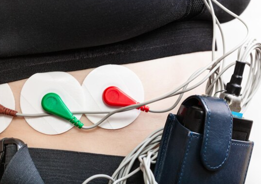 Eletrodo para eletrocardiograma descartável: quando vale mais a pena do que o reutilizável